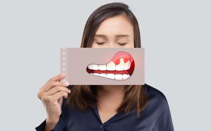 Are Dental Providers the Missing Link in Cancer Care?