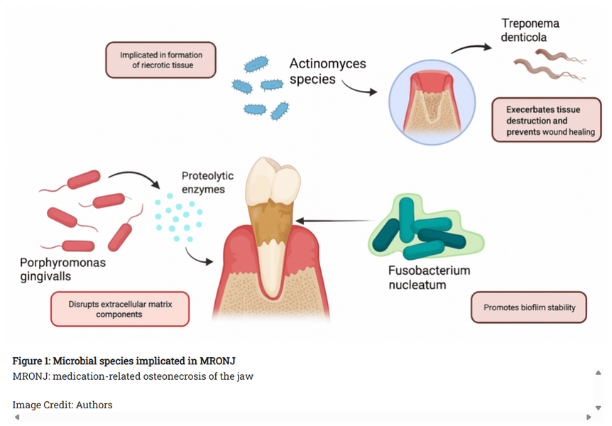 Potential Role of Oral Microbiota in Medication-Related Osteonecrosis of the Jaw in Cancer Patients: A Narrative Review