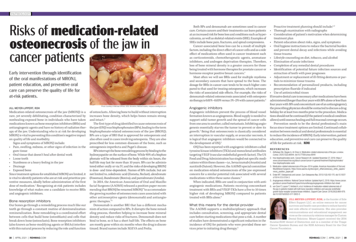 Risks of medication-related osteonecrosis of the jaw in cancer patients (RDH Magazine)
